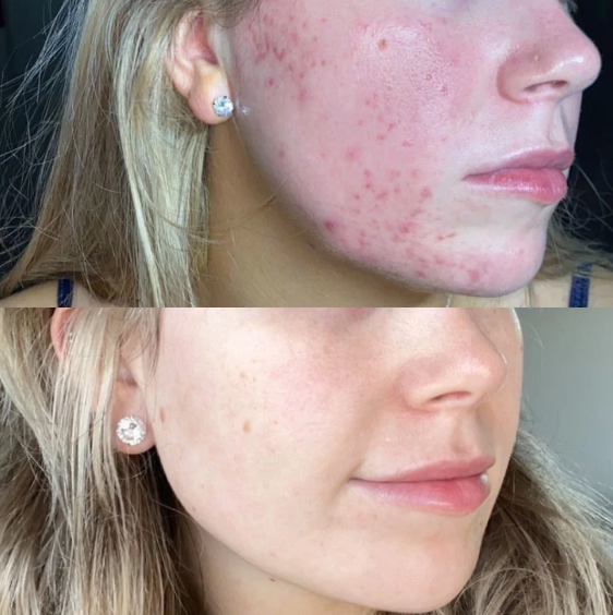 Eco Tan Serum Of Clear 30ml